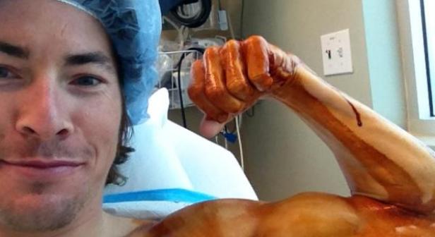 Nicky Hayden to undergo left-shoulder surgery to speed recovery 
